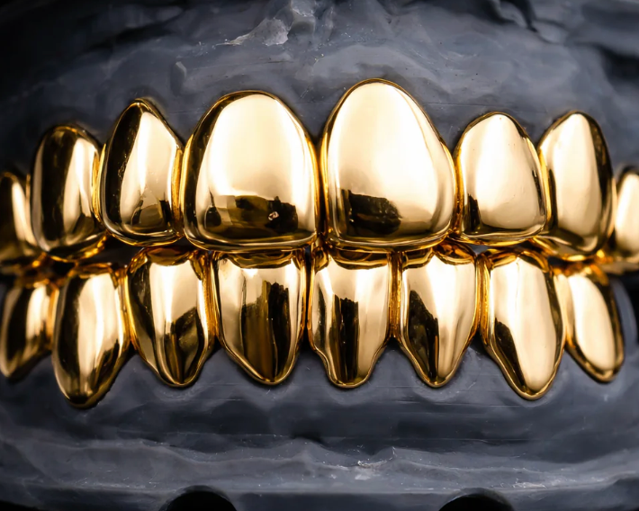 10K Gold Grillz